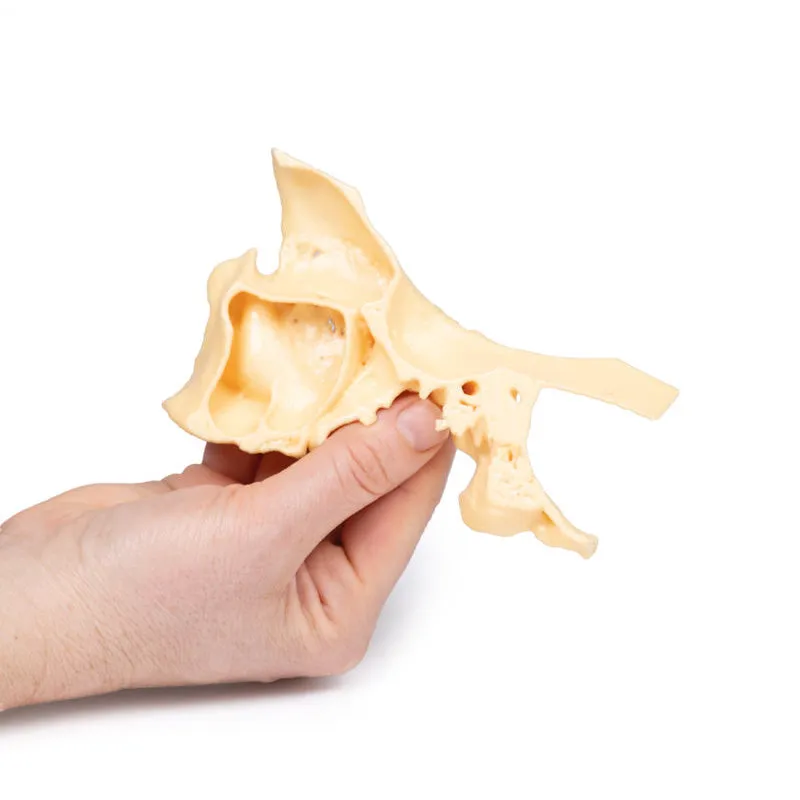 3D Printed Paranasal Sinus Model