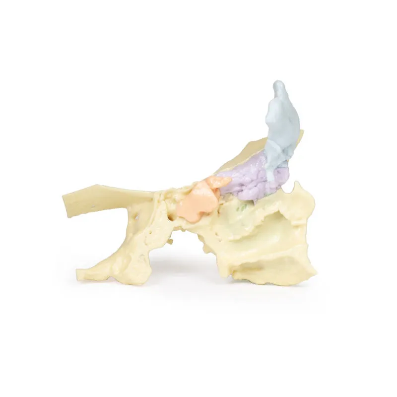 3D Printed Paranasal Sinus Model