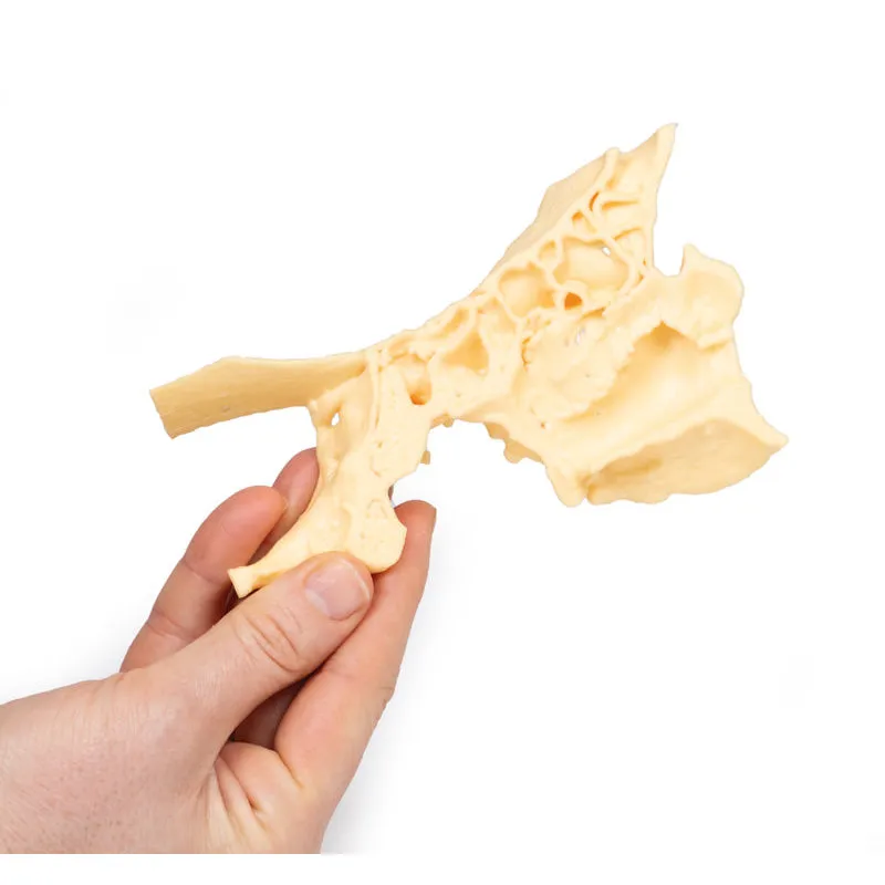 3D Printed Paranasal Sinus Model