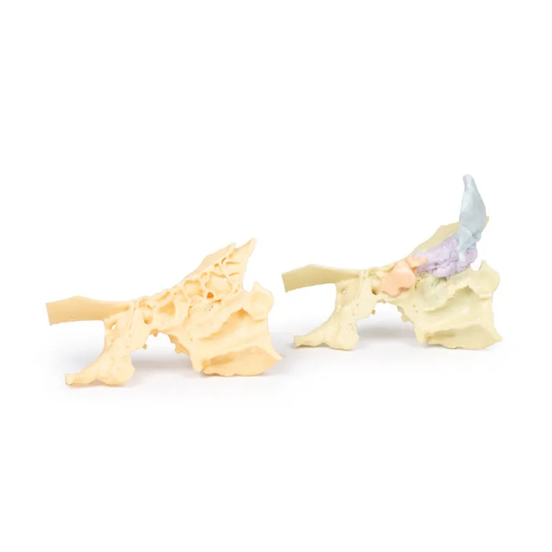 3D Printed Paranasal Sinus Model