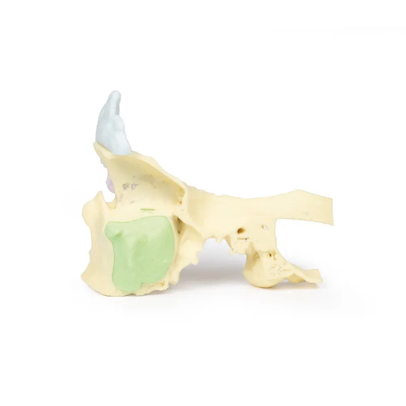 3D Printed Paranasal Sinus Model